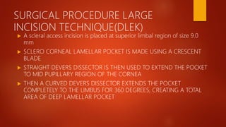 SURGICAL PROCEDURE LARGE
INCISION TECHNIQUE(DLEK)
 A scleral access incision is placed at superior limbal region of size 9.0
mm
 SCLERO CORNEAL LAMELLAR POCKET IS MADE USING A CRESCENT
BLADE
 STRAIGHT DEVERS DISSECTOR IS THEN USED TO EXTEND THE POCKET
TO MID PUPILLARY REGION OF THE CORNEA
 THEN A CURVED DEVERS DISSECTOR EXTENDS THE POCKET
COMPLETELY TO THE LIMBUS FOR 360 DEGREES, CREATING A TOTAL
AREA OF DEEP LAMELLAR POCKET
 