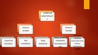 . LAMELLAR
KERATOPLAST
Y
Anterior
lamellar
Superficial
ALK(SALK)
Mid
ALK(MALK)
Deep
ALK(DALK)
Posterior
lamellar
Deep Lamellar
Endothelial
Keratoplasty(D
LEK)
Descemet’s
stripping
Automated endo
thelium
keratoplasty
DSAEK
 