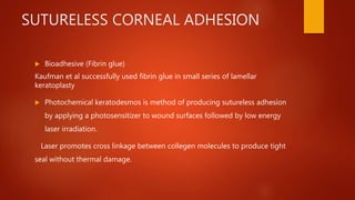 SUTURELESS CORNEAL ADHESION
 Bioadhesive (Fibrin glue)
Kaufman et al successfully used fibrin glue in small series of lamellar
keratoplasty
 Photochemical keratodesmos is method of producing sutureless adhesion
by applying a photosensitizer to wound surfaces followed by low energy
laser irradiation.
Laser promotes cross linkage between collegen molecules to produce tight
seal without thermal damage.
 