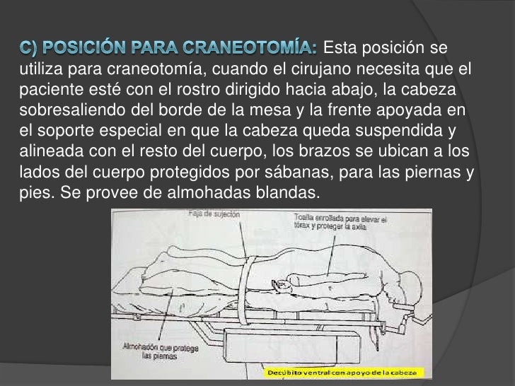 Los miembros grandes arrancan los pequeños loritos