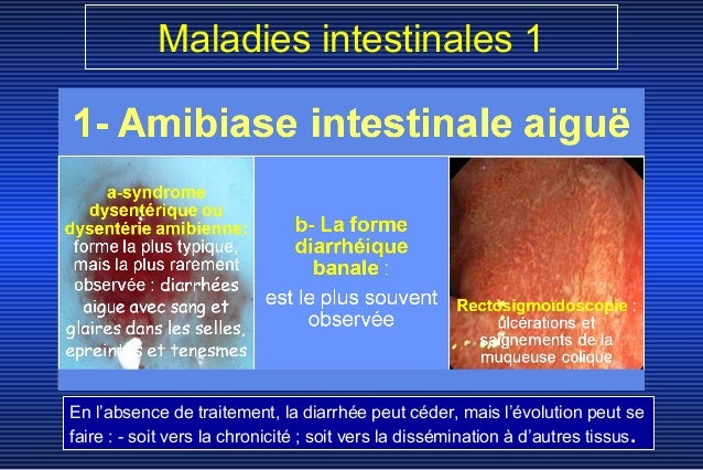 Amibiase intestinale