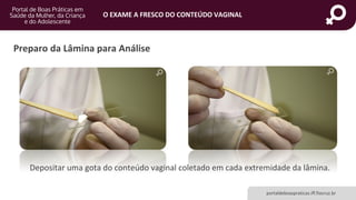 portaldeboaspraticas.iff.fiocruz.br
O EXAME A FRESCO DO CONTEÚDO VAGINAL
Preparo da Lâmina para Análise
Depositar uma gota do conteúdo vaginal coletado em cada extremidade da lâmina.
 