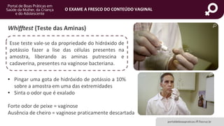 portaldeboaspraticas.iff.fiocruz.br
O EXAME A FRESCO DO CONTEÚDO VAGINAL
• Pingar uma gota de hidróxido de potássio a 10%
sobre a amostra em uma das extremidades
• Sinta o odor que é exalado
Whifftest (Teste das Aminas)
Forte odor de peixe = vaginose
Ausência de cheiro = vaginose praticamente descartada
Esse teste vale-se da propriedade do hidróxido de
potássio fazer a lise das células presentes na
amostra, liberando as aminas putrescina e
cadaverina, presentes na vaginose bacteriana.
 