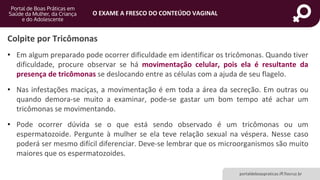 portaldeboaspraticas.iff.fiocruz.br
O EXAME A FRESCO DO CONTEÚDO VAGINAL
• Em algum preparado pode ocorrer dificuldade em identificar os tricômonas. Quando tiver
dificuldade, procure observar se há movimentação celular, pois ela é resultante da
presença de tricômonas se deslocando entre as células com a ajuda de seu flagelo.
• Nas infestações maciças, a movimentação é em toda a área da secreção. Em outras ou
quando demora-se muito a examinar, pode-se gastar um bom tempo até achar um
tricômonas se movimentando.
• Pode ocorrer dúvida se o que está sendo observado é um tricômonas ou um
espermatozoide. Pergunte à mulher se ela teve relação sexual na véspera. Nesse caso
poderá ser mesmo difícil diferenciar. Deve-se lembrar que os microorganismos são muito
maiores que os espermatozoides.
Colpite por Tricômonas
 