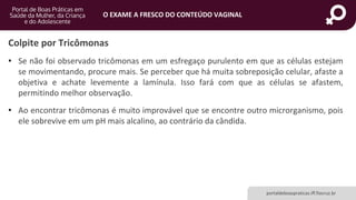 portaldeboaspraticas.iff.fiocruz.br
O EXAME A FRESCO DO CONTEÚDO VAGINAL
• Se não foi observado tricômonas em um esfregaço purulento em que as células estejam
se movimentando, procure mais. Se perceber que há muita sobreposição celular, afaste a
objetiva e achate levemente a lamínula. Isso fará com que as células se afastem,
permitindo melhor observação.
• Ao encontrar tricômonas é muito improvável que se encontre outro microrganismo, pois
ele sobrevive em um pH mais alcalino, ao contrário da cândida.
Colpite por Tricômonas
 