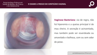 portaldeboaspraticas.iff.fiocruz.br
O EXAME A FRESCO DO CONTEÚDO VAGINAL
Vaginose Bacteriana: via de regra, não
há hiperemia e a queixa principal é de
mau cheiro. A secreção é acinzentada,
mas também pode ser esverdeada ou
amarelada e bolhosa, com ou sem odor
de peixe.
 