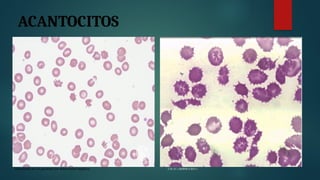 LAMINA PERIFERICA EXPO (1).pptxGHDFGDGDFGD | PPTX