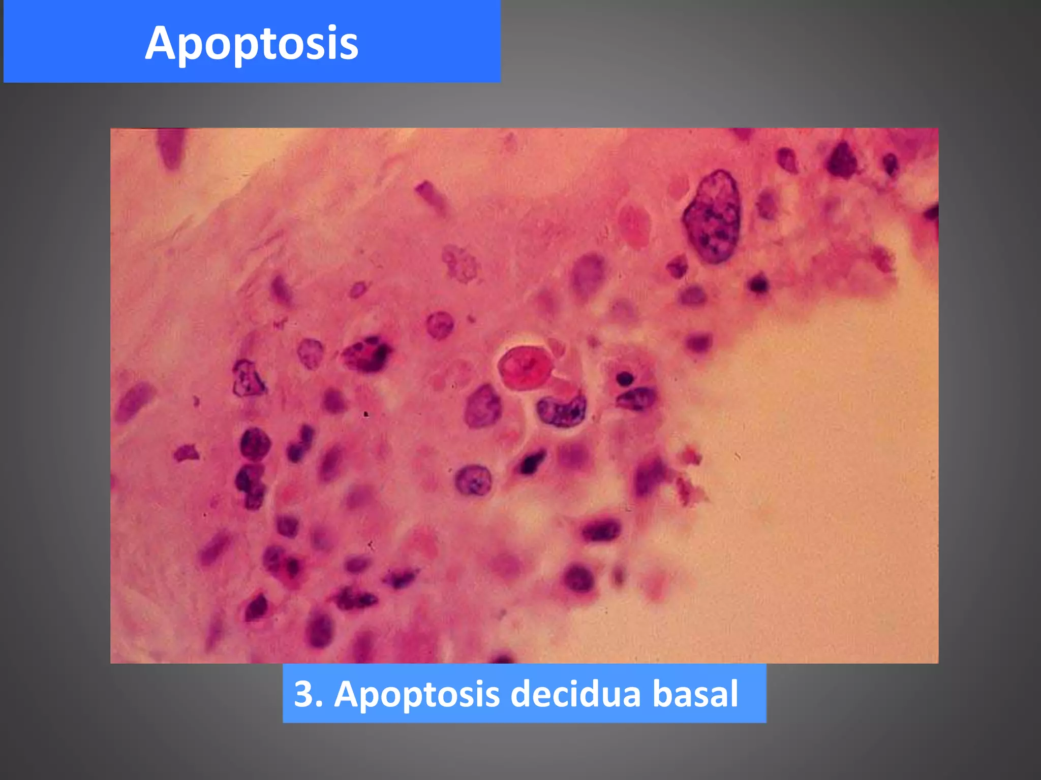 Laminario de morfofisiopatologia humana 1 2018 PPT