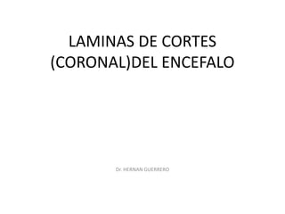 LAMINAS DE CORTES
(CORONAL)DEL ENCEFALO
Dr. HERNAN GUERRERO
 