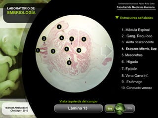 LABORATORIO DE
EMBRIOLOGÍA
Facultad de Medicina Humana
Universidad nacional Pedro Ruiz Gallo
Estrucutras señaladas
Manuel Arrelucea ®
Chiclayo - 2010
Aumentos
1. Médula Espinal
2. Gang. Raquídeo
3. Aorta descendente
4. Esbozos Miemb. Sup
5. Mesonefros
1
2
3
4
5
6. Hígado
6
7. Epiplón
8. Vena Cava inf.
9
9. Estómago
7
8
10
10. Conducto venoso
Vista izquierda del campo
100x40xLámina 13
 