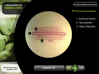 LABORATORIO DE
EMBRIOLOGÍA
Facultad de Medicina Humana
Universidad nacional Pedro Ruiz Gallo
Estrucutras señaladas
Manuel Arrelucea ®
Chiclayo - 2010
Aumentos
1. Conducto central
2. Neuroepitelio
3. Gang. Raquídeo
1
2
3
Lámina 18 100x40x
 