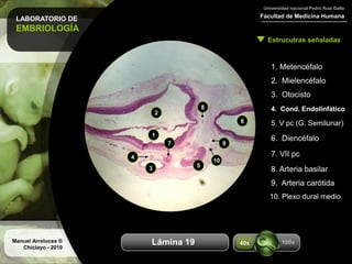 LABORATORIO DE
EMBRIOLOGÍA
Facultad de Medicina Humana
Universidad nacional Pedro Ruiz Gallo
Estrucutras señaladas
Manuel Arrelucea ®
Chiclayo - 2010
Aumentos
1. Metencéfalo
2. Mielencéfalo
3. Otocisto
4. Cond. Endolinfático
5. V pc (G. Semilunar)
1
2
3
4
5
6. Diencéfalo
6
7. VII pc
8. Arteria basilar
9
9. Arteria carótida
7
8
10. Plexo dural medio
100x40xLámina 19
10
 