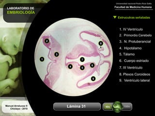 LABORATORIO DE
EMBRIOLOGÍA
Facultad de Medicina Humana
Universidad nacional Pedro Ruiz Gallo
Estrucutras señaladas
Manuel Arrelucea ®
Chiclayo - 2010
Aumentos
1. IV Ventrículo
2. Primordio Cerebelo
3. N. Protuberancial
4. Hipotálamo
5. Tálamo
1
2
3
4 5
6. Cuerpo estriado
6
7. III Ventrículo
8. Plexos Coroideos
9. Ventrículo lateral
8
100x40xLámina 31
7
9
 