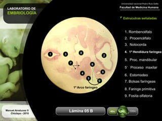 LABORATORIO DE
EMBRIOLOGÍA
Facultad de Medicina Humana
Universidad nacional Pedro Ruiz Gallo
Estrucutras señaladas
Manuel Arrelucea ®
Chiclayo - 2010
Aumentos
1. Rombencéfalo
2. Procencéfalo
3. Notocorda
4. 1º Hendidura faríngea
5. Proc. mandibular
5’ Proceso maxilar
1 23
4
5
5’
1º Arco faríngeo
6. Estomodeo
67
7. Bolsas faríngeas
8
8. Faringe primitiva
9
9. Fosita olfatoria
100x40xLámina 05 B
 