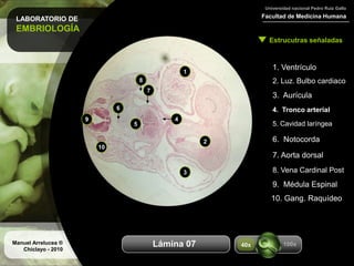 LABORATORIO DE
EMBRIOLOGÍA
Facultad de Medicina Humana
Universidad nacional Pedro Ruiz Gallo
Estrucutras señaladas
Manuel Arrelucea ®
Chiclayo - 2010
Aumentos
1. Ventrículo
2. Luz. Bulbo cardiaco
3. Aurícula
4. Tronco arterial
5. Cavidad laríngea
1
2
3
4
5
6. Notocorda
6
7. Aorta dorsal
8. Vena Cardinal Post
9
9. Médula Espinal
7
8
10
10. Gang. Raquídeo
100x40xLámina 07
 
