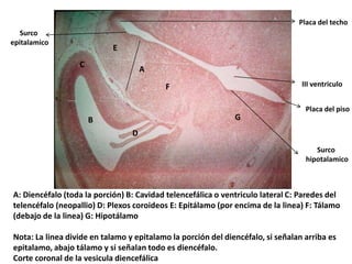 Placa del techo Surco  epitalamico E C A III ventriculo F Placa del piso G B D Surco  hipotalamico A: Diencéfalo (toda la porción) B: Cavidad telencefálica o ventriculo lateral C: Paredes del telencéfalo (neopallio) D: Plexos coroideos E: Epitálamo (por encima de la linea) F: Tálamo (debajo de la linea) G: Hipotálamo Nota: La linea divide en talamo y epitalamo la porción del diencéfalo, si señalan arriba es epitalamo, abajo tálamo y si señalan todo es diencéfalo. Corte coronal de la vesiculadiencefálica 