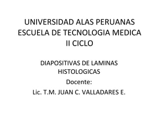 UNIVERSIDAD ALAS PERUANAS ESCUELA DE TECNOLOGIA MEDICA II CICLO DIAPOSITIVAS DE LAMINAS HISTOLOGICAS Docente: Lic. T.M. JUAN C. VALLADARES E. 