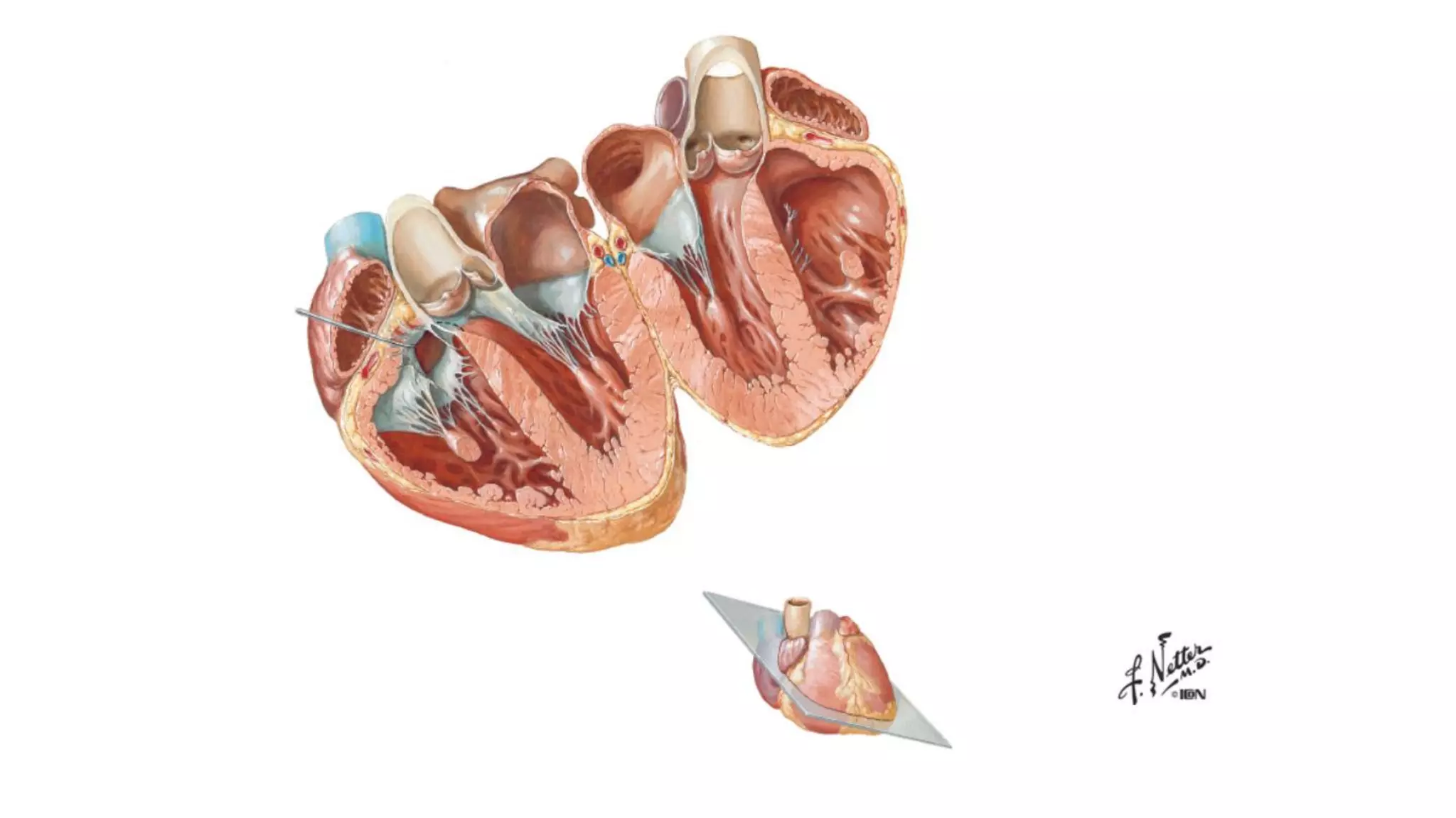 Laminas de la anatomia del corazón- Netter | PDF
