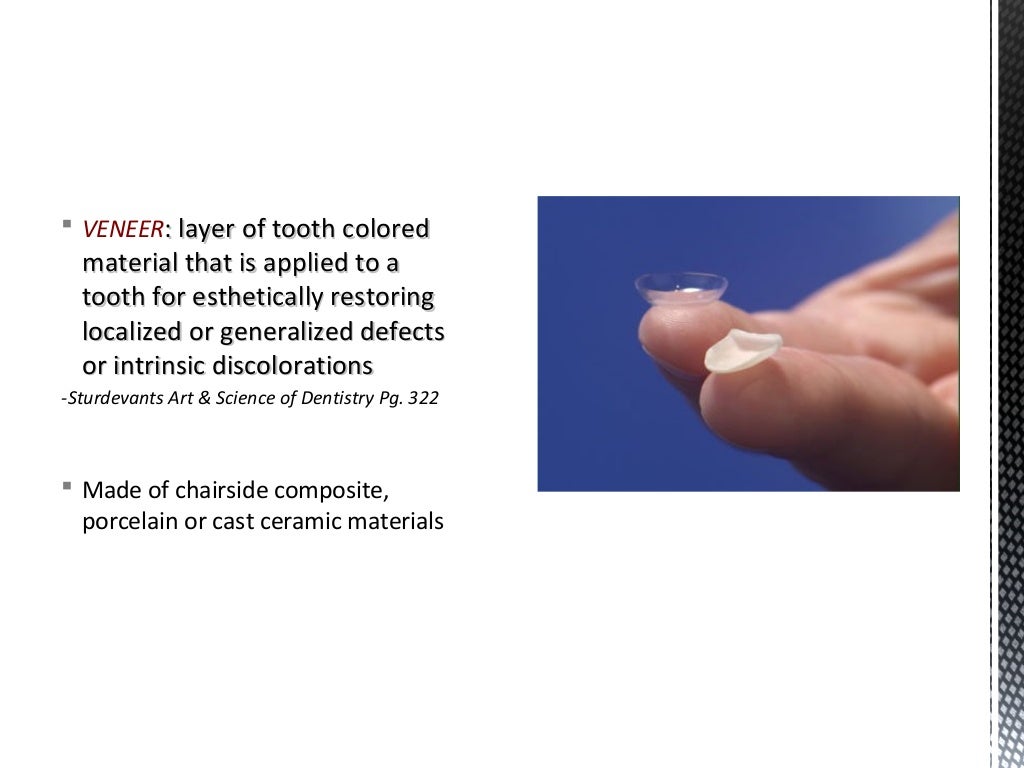 Dental Veneers & Laminates