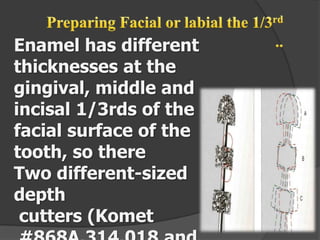Enamel has different
thicknesses at the
gingival, middle and
incisal 1/3rds of the
facial surface of the
tooth, so there
Two different-sized
depth
cutters (Komet

 
