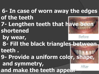 6- In case of worn away the edges
of the teeth
7- Lengthen teeth that have been
shortened
by wear,
8- Fill the black triangles between
teeth .
9- Provide a uniform color, shape,
and symmetry,
and make the teeth appear

 