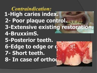 1-High caries index.
2- Poor plaque control.
3-Extensive existing restoration.
4-BruxximS.
5-Posterior teeth.
6-Edge to edge or cross bite.
7- Short teeth.
8- In case of orthodontics.

 