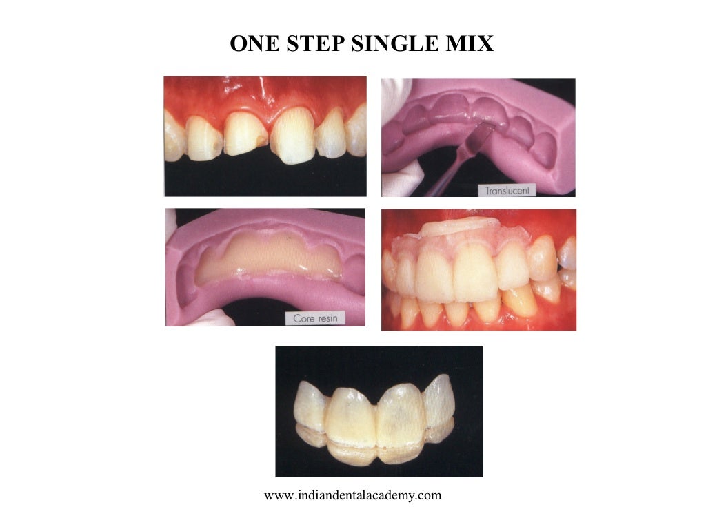 Laminate /dental courses