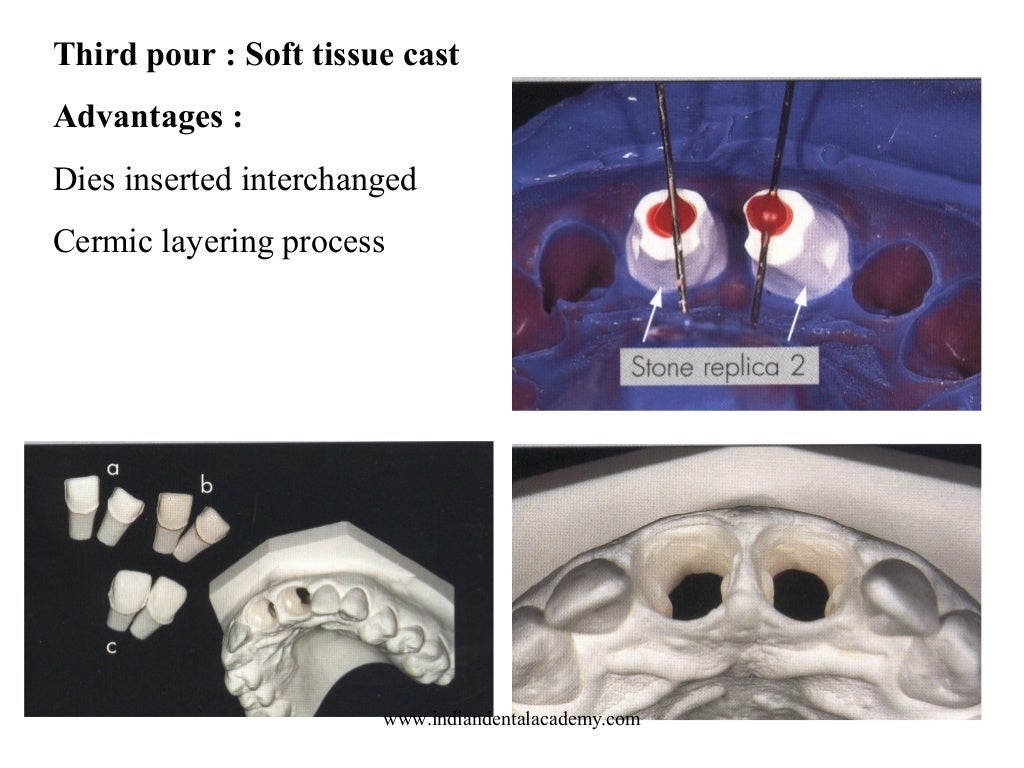 Laminate /dental courses