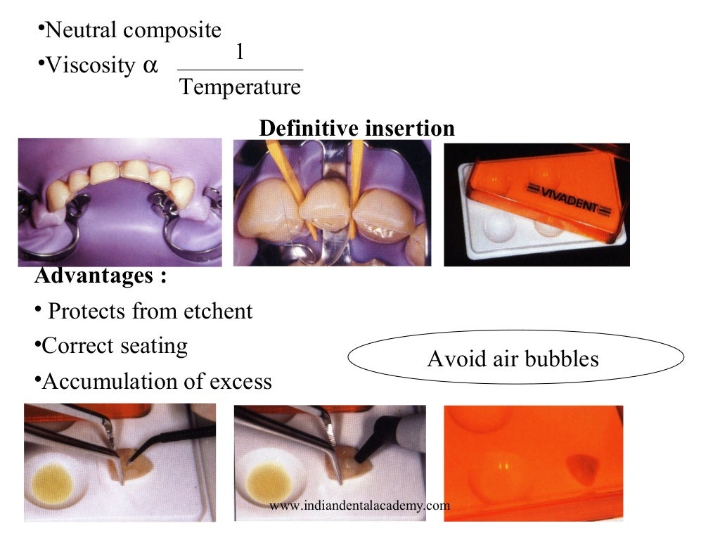 Laminate /dental courses