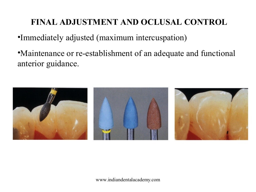 Laminate /dental courses