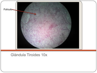 Folículo




      Glándula Tiroides 10x
 
