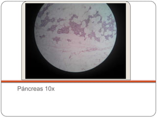 Páncreas 10x
 