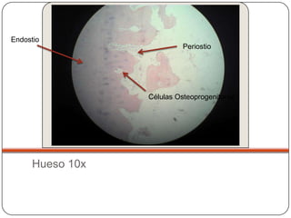 Endostio
                           Periostio




                 Células Osteoprogenitoras




     Hueso 10x
 