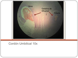 Vena
                       Gelatina de
                       Wharton
                                     Arteria




Cordón Umbilical 10x
 