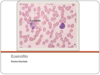 Eosinófilo




Eosinófilo
Núcleo biloulado
 