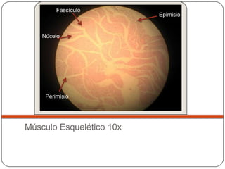 Fascículo
                          Epimisio


    Núcelo




     Perimisio




Músculo Esquelético 10x
 