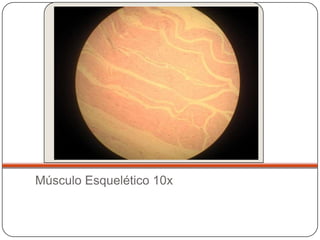 Músculo Esquelético 10x
 