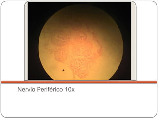 Nervio Periférico 10x
 
