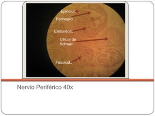 Epineiuro

              Perineuro


             Endoneuro

                Célula de
                Schwan



              Fáscículo




Nervio Periférico 40x
 