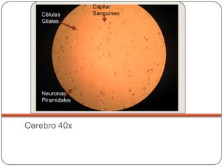 Capilar
   Células       Sanguíneo
   Gliales




   Neuronas
   Piramidales



Cerebro 40x
 