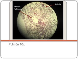 Arteria
   Alveolo
   Pulmonar




Pulmón 10x
 