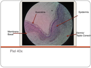 Queratina     Epidermis




Membrana
                        Dermis/
Basal
                        Tejido Conectiv




 Piel 40x
 