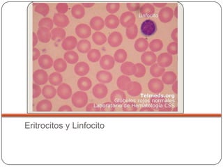 Eritrocitos y Linfocito
 