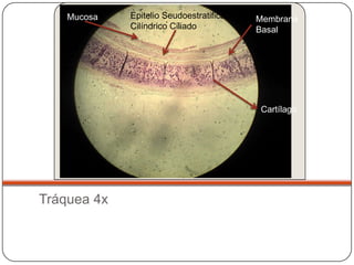 Mucosa   Epitelio Seudoestratificado   Membrana
             Cilíndrico Ciliado            Basal




                     ...
