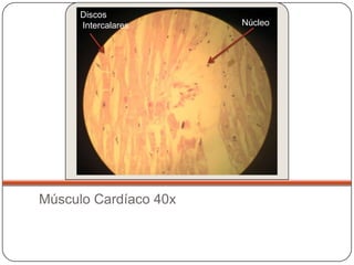 Discos
      Intercalares     Núcleo




Músculo Cardíaco 40x
 