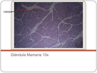 Lóbulos




     Glándula Mamaria 10x
 