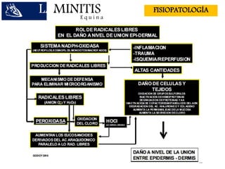 LAMINITISE q u i n a
FISIOPATOLOGÍA
 