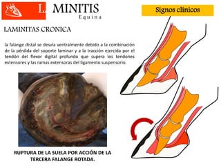LAMINITISE q u i n a
LAMINITAS CRONICA
la falange distal se desvía ventralmente debido a la combinación
de la pérdida del soporte laminar y a la tracción ejercida por el
tendón del flexor digital profundo que supera los tendones
extensores y las ramas extensoras del ligamento suspensorio.
RUPTURA DE LA SUELA POR ACCIÓN DE LA
TERCERA FALANGE ROTADA.
Signos clínicos
 