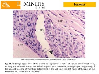 LAMINITISE q u i n a
Lesiones
Fig. 2B. Histologic appearance of the dermal and epidermal lamellae of hooves of laminitis horses,
showing the basement membrane stained magenta with serrated-appearing shape, straightening of
the SEL and tapering of their tips, detachment of the SDL from the BM, nuclei at the apex of the
basal cells (BC) are rounded. PAS. 600x.
http://www.scielo.cl/scielo.php?script=sci_arttext&pid=S0717-95022004000400012
 