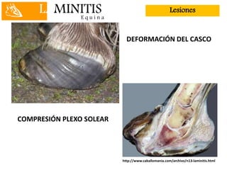 LAMINITISE q u i n a
Lesiones
DEFORMACIÓN DEL CASCO
COMPRESIÓN PLEXO SOLEAR
http://www.caballomania.com/archivo/n13-laminitis.html
 